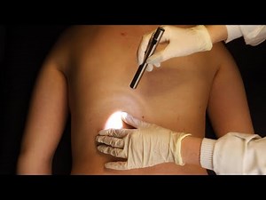 ASMR | BACK INSPECTION (Tingly Friday)