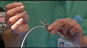 Endoscopy: Benefits of the Scope