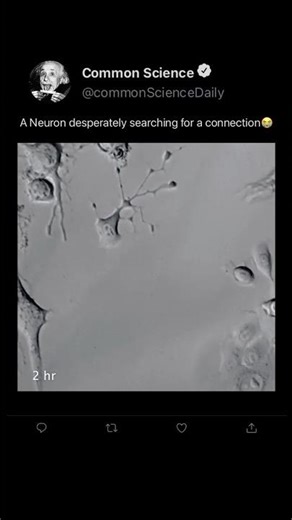 A Neuron Desperately Searching For a Connection 😭 #science #neuroscience #brain