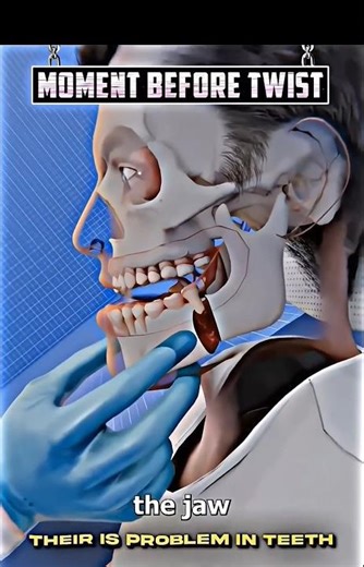 How Doctors Fix Your Jaw! (Step-by-Step)🛠️