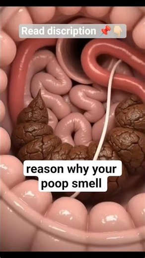 reason why your poop 💩 smell ⚠️ #shortvideo #sjorts #shorts
