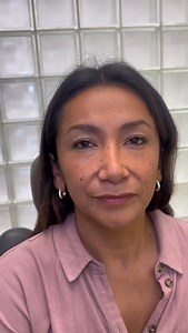 A lift designed to bring light back into the face. One year post revision rhinoplasty, endoscopic brow and midface lift, and lip lift. To schedule an appointment: Phone: 212-288-3000 WhatsApp: 201-875-8482 Or send us a private DM. Offices in New York City & New Jersey Virtual Consultations Available Disclaimer: We do not own or claim to own the audio in this video. All rights and permissions belong to the original creator. | Kassir Plastic Surgery New Jersey New York