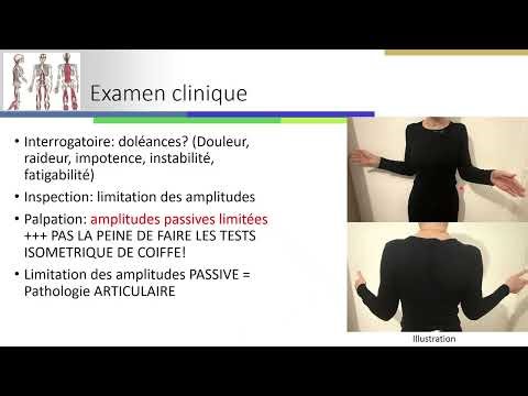 Adhesive capsulitis: intra-articular shoulder infiltration under ultrasound guidance.