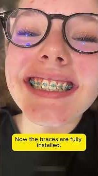 How Braces Actually Move Your Teeth | The Science Behind Orthodontics