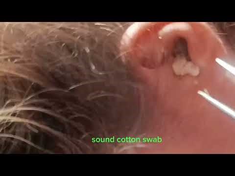 Relaxing Ear Check & Cleaning | ASMR Sleep