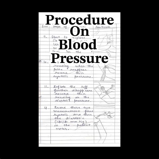 #𝐏𝐫𝐨𝐜𝐞𝐝𝐮𝐫𝐞𝐎𝐧𝐁𝐥𝐨𝐨𝐝𝐏𝐫𝐞𝐬𝐬𝐮𝐫𝐞#shortsfeed#viralshort