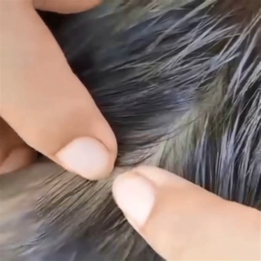 Getting out all lice from short hair | Natural Lice