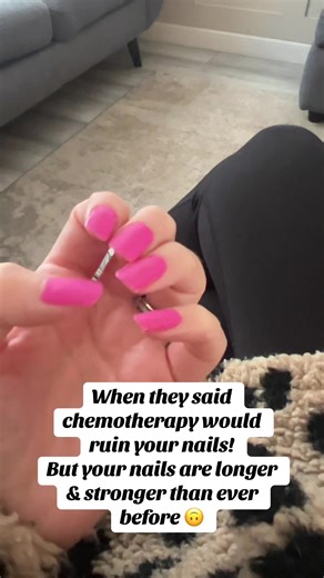 Transforming Nails Through Chemotherapy: A Positive Journey