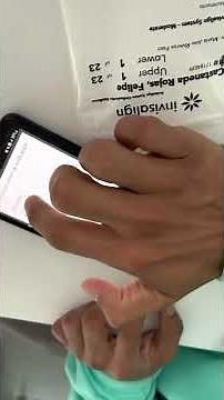 Paso a Paso de la App My Invisalign