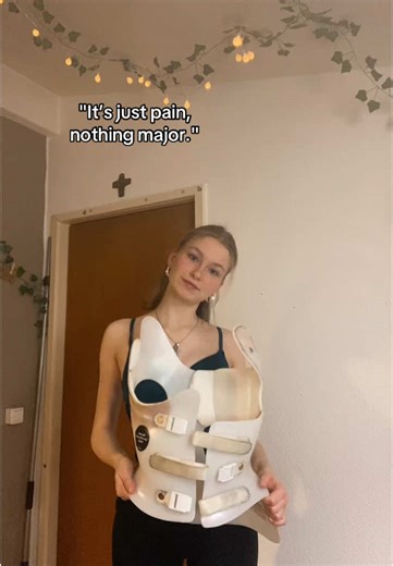 Scoliosis Brace Guide: Vintage Milwaukee Style Insights