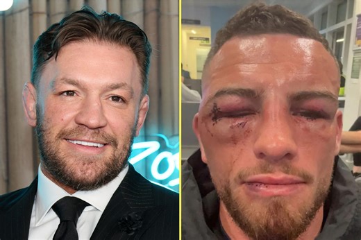 Conor McGregor hails brutal bare-knuckle bout that left new champ unrecognisable
