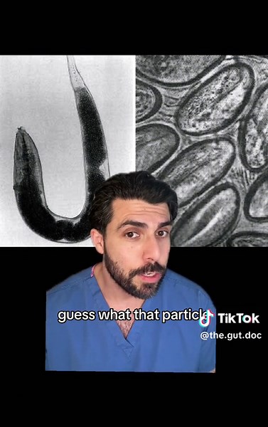 Have you been itching your butt lately? #pinworms #parasite #worms #guthealth #greenscreen