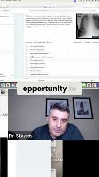AMBOSS vs UWorld: The TRUTH No One Tells You