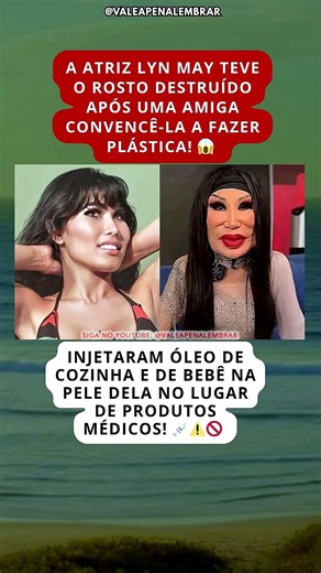 STOLEN BEAUTY: The Mexican actress whose face was disfigured.