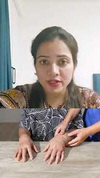 what is Rheumatoid Arthritis??