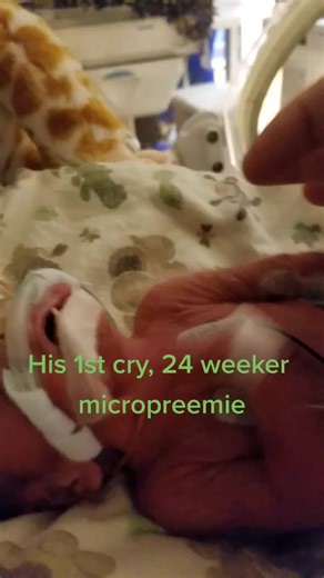 Heartbreaking Micro Preemie Baby's Cry | ROMWE Get Graphic