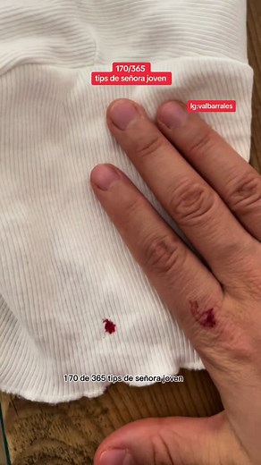Elimina manchas de sangre de tu ropa fácilmente