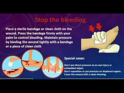 How to stop bleeding ( First Aid )