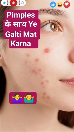 Pimple Ko Dabane Se Kya Hota Hai? | Acne Mistakes You Must Avoid | Pimples Tips Hindi #Shorts