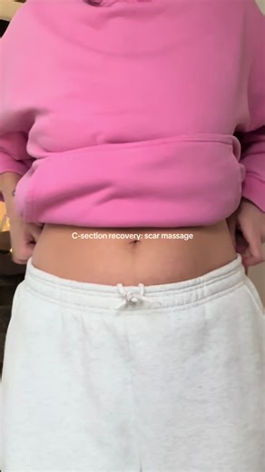 #csectionrecovery #positivecsection #firsttimemum | c section