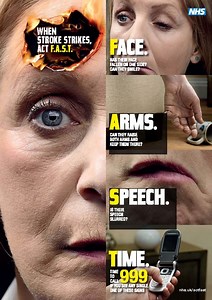 Recognising a Stroke - the FAST Test - First Aid for Free