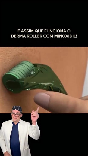 Dermatologista Brasília on Instagram: "✨ É ASSIM QUE FUNCIONA O DERMA ROLLER COM MINOXIDIL! ✨ Pouca gente sabe, mas o Derma Roller potencializa a absorção do Minoxidil, fazendo o ativo penetrar mais profundamente no couro cabeludo e estimulando os folículos de forma muito mais eficaz. 💪 Resultado: fios mais fortes, crescimento acelerado e até recuperação de áreas com falhas! 😬 Mas atenção: o uso incorreto pode causar o efeito contrário. Agulhas erradas, excesso de produto ou falta de higiene p