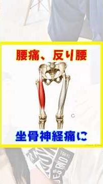 腰痛、反り腰、坐骨神経痛解消！大腿直筋リリース