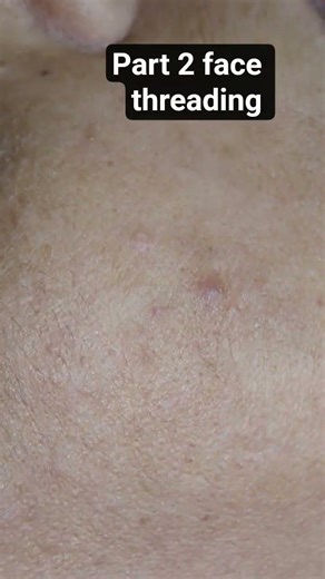 #face threading after result