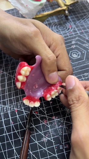 Wax up 😬 #dentallaboratory #denture#flexibledenture #valplastdenture #acrylicdenture