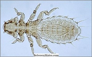 Unterschied zwischen Parasiten und Bakterien | Parasit vs Bakterien - Wissenschaft & Natur 2025