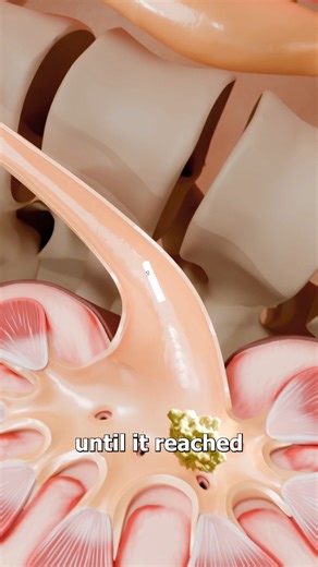 Tiny Robots That Dissolve Kidney Stones 😮 | Zack D. Films