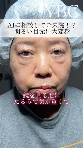 Consult with AI before visiting our clinic #UnderEyeCircles #DarkCircleRemoval #Beauty #Rejuvenat...