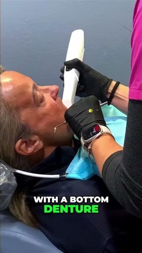 🦷 Partial Denture Nightmare – Full Implants Are the Answer!