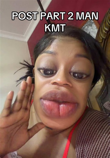 Post Part 2 Man KMT — where is part 2?