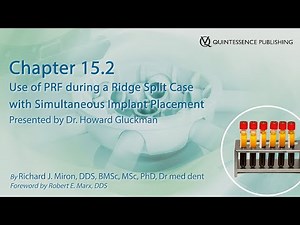 Chapter 15.2: Use of PRF during a Ridge Split Case with Simultaneous Implant Placement