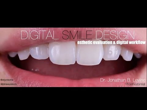 Identify-Visualize-Choose: A 3-Step Approach to Full Facial Esthetics-driven Smile Design