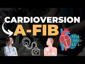 Cardioversion Procedure: Steps and Video | E Healthy Info #cardioversion