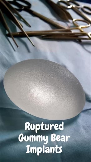 Dr. Dallas Wolford | What we actually mean when we say Gummy Bear Implant!👀 When are you getting yours? #gummybearimplant #breastaugmentation... | Instagram