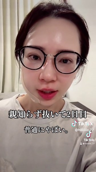 親知らず抜歯後1週間の経過まとめ