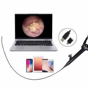 [Hot Item] Surgical Diagnostic Equipment HD Portable Integrated Electronic Ureteroscopy