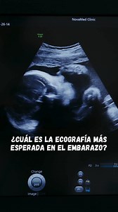 ¿Cuál es la ecografía más esperada en el embarazo?🥹🥹🫄 | Mi Embarazo semana a semana
