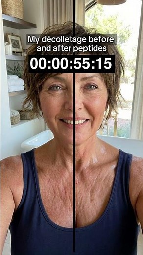 My Décolletage Before & After Peptides