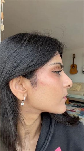 Redness and texture visible through makeup is NORMAL!! #acne #skincare #dermatology #skincareroutine