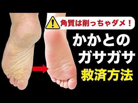 削っちゃダメ！ガサガサかかとを7日でツルツルにする方法（※再発しない）