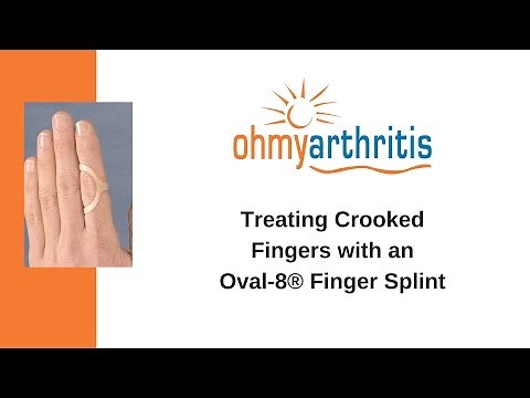How to Treat a Crooked Finger with an Oval-8 Finger Splint - Oh My Arthritis