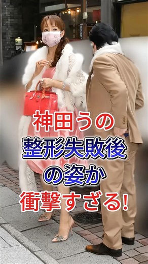神田うの整形失敗後の姿か衝擊すざる!#神田うの#芸能人#fiy