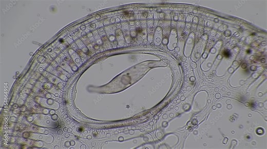 Microscopic worm in intestinal parasite, magnified view in the lab; for medical education