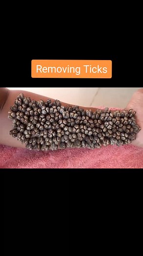 Removing Ticks #asmr #satisfying #asmrcommunity #foryou #viral | tick removal