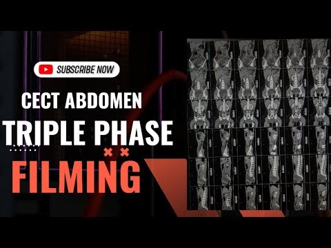 👩‍⚕️HOW TO DO CECT ABDOMEN TRIPLE PHASE FILMING ||PROCESS||ARTERIAL, PORTAL AND VENOUS PHASES||🥼