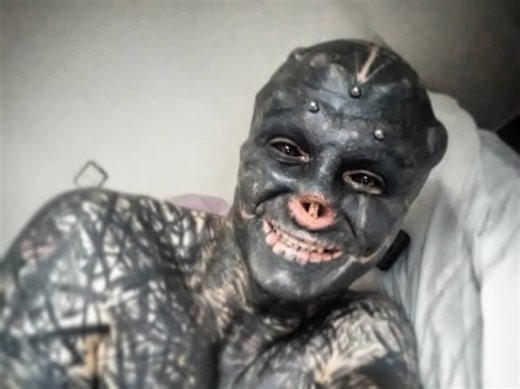 French man who removed ears, nose and fingers claims his Black Alien transformation is 71% done